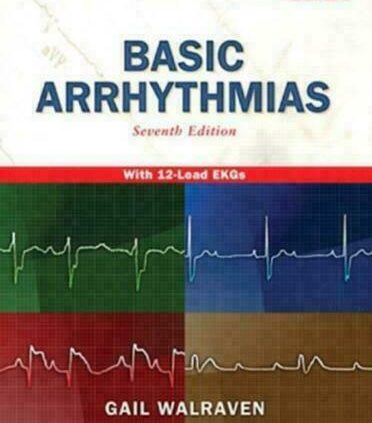 Smartly-liked Arrhythmias, 7th Edition by Gail Walraven [PĐF]