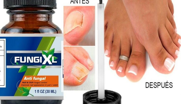 Anti Fungal Nail Treatment Liquid Toe Nail Finger Fungus Onychomycosis Thickened
