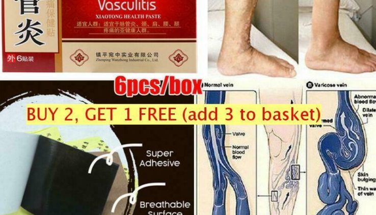 Varicose Veins Therapeutic Patch Plasters Clinical Therapy Chinese Natural System!