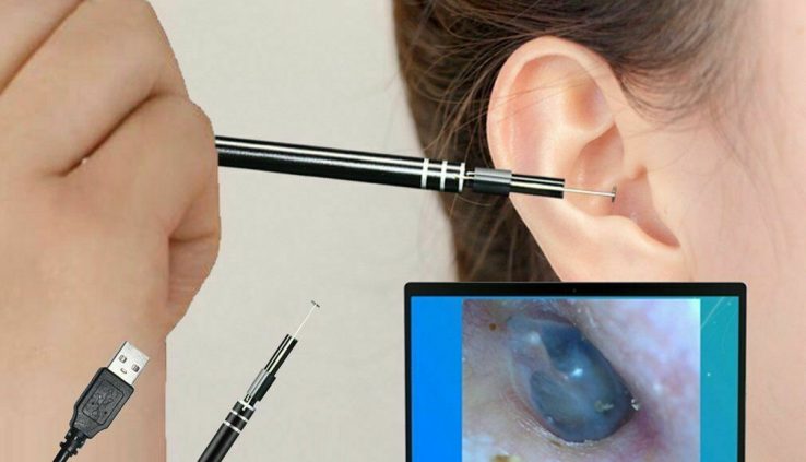 Health Care Instrument Ear Exhaust Wax Remover Cleaner scope Endoscope residence windows PC USB CM