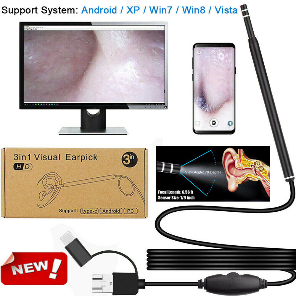 3in1 Ear Cleaning Endoscope USB 5.5mm Visible Earpick HD Digicam Spoon