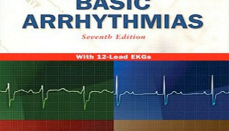 Frequent Arrhythmias 7th Model by Gail Walraven ..P..D..F..